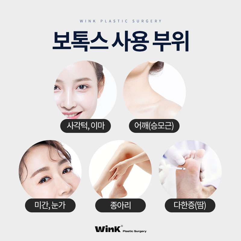 윙크성형외과 보톡스로 티 안나게 예뻐지자! 관련 이미지 3