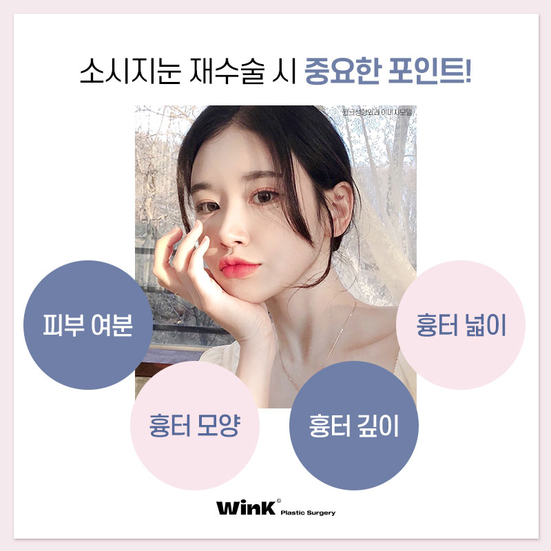 Thick, High Double Eyelid Lines and a Sausage-Like Eye! Solve It with Wink Double-Line Revision Surgery! image 7