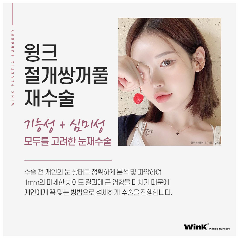 절개쌍꺼풀재수술 쌍수재수술  윙크성형외과 쌍꺼풀재수술 쌍꺼풀재수술후기 관련 이미지 4