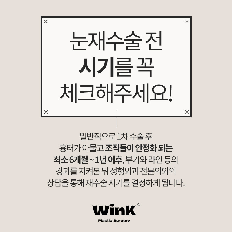 눈재수술 잘하는병원 마지막 눈재수술 관련 이미지 3