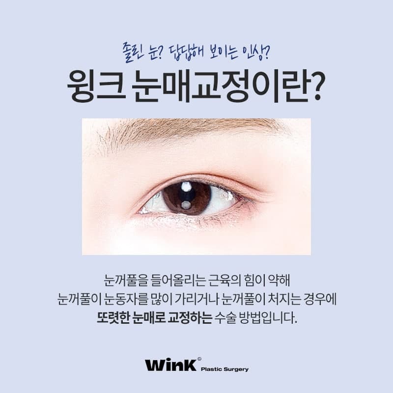 윙크성형외과 비절개 or 절개 눈매교정! 나에게 맞는 눈매교정은? 관련 이미지 2
