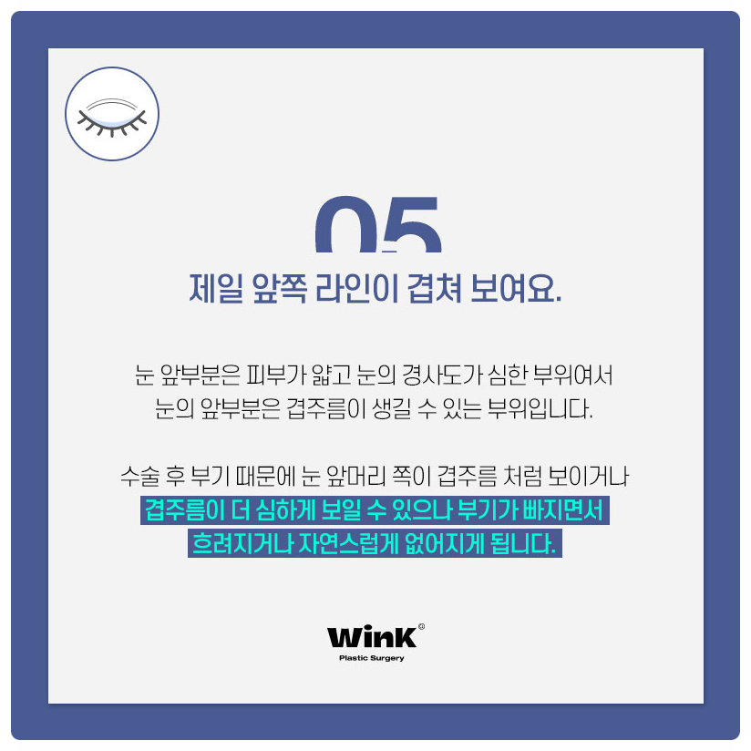 Post-Double Eyelid Surgery Care Methods: Follow the Guidance from Wink Plastic Surgery! Swelling After Double Eyelid Surgery image 6