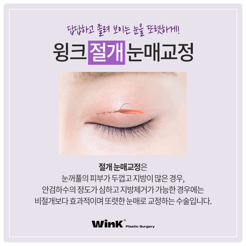 If you are looking into ptosis correction and double eyelid surgery before and after ptosis correction surgery at Sinsa Station, Wink Plastic Surgery image 6