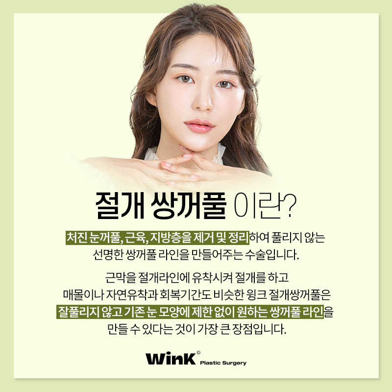 풀릴 걱정 없는 윙크성형외과 절개쌍꺼풀 관련 이미지 3