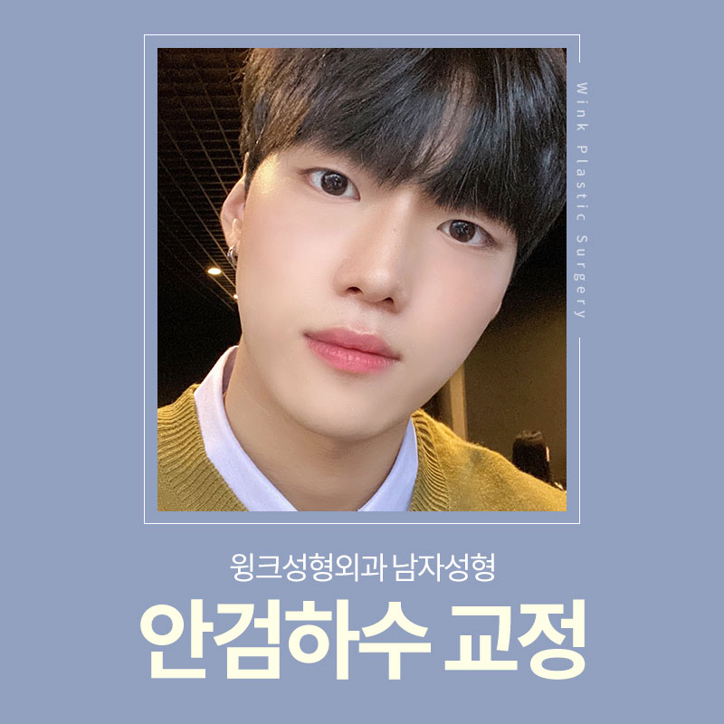남자안검하수 또렷하게 교정하여 시원한 인상으로 개선하는 방법 관련 이미지 1