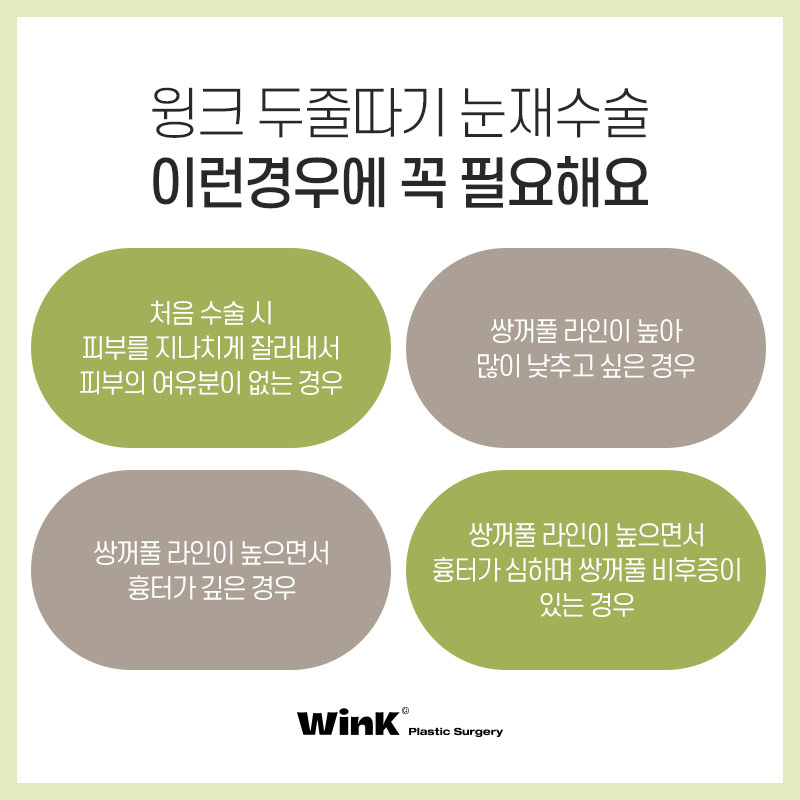두꺼운 소세지눈? 윙크성형외과 두줄따기 눈재수술로 라인낮추기! 관련 이미지 3
