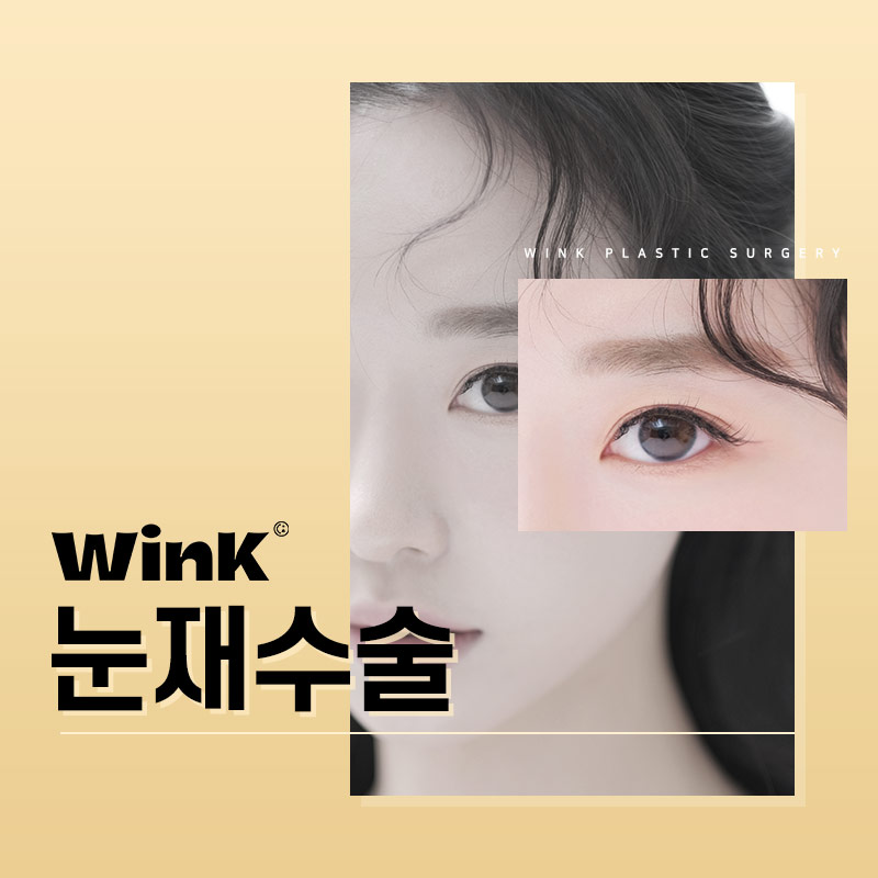 절개 쌍수 재수술에 대해 알아보겠습니다. 관련 이미지 1