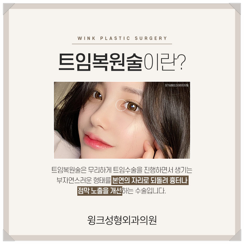 Recovery Period After Epicanthoplasty Restoration, Epicanthoplasty Scar, If You’re Only Looking Into Epicanthoplasty, Wink Plastic Surgery image 2