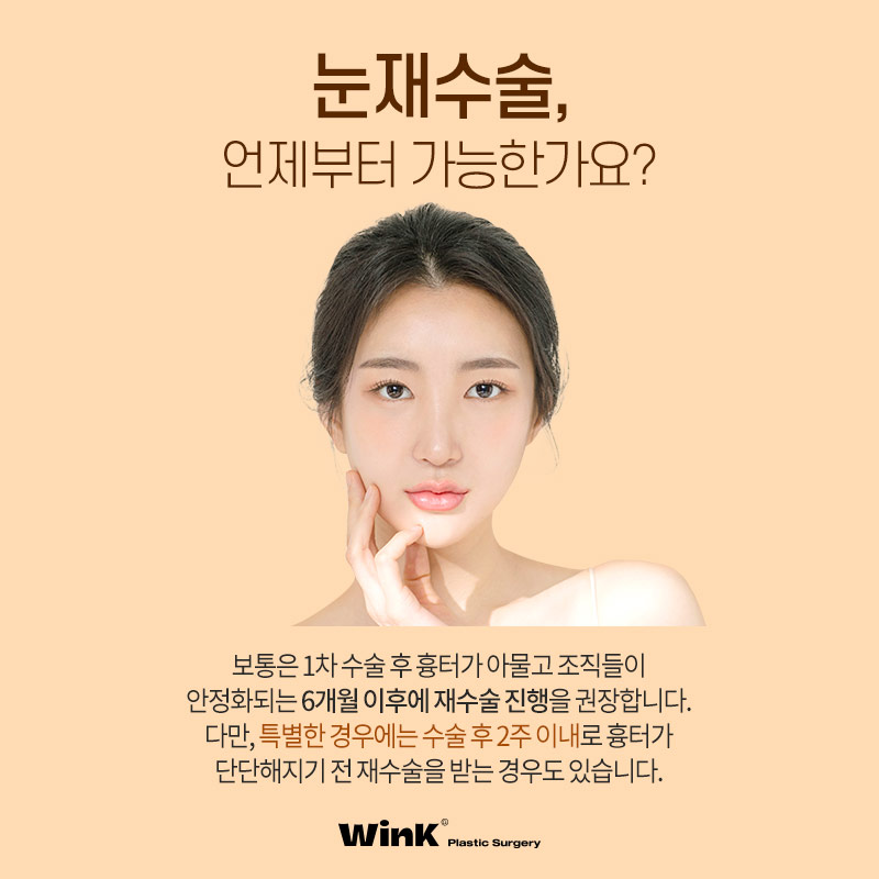 쌍꺼풀재수술 쌍수재수술후기 윙크성형외과 신사눈재수술비용 관련 이미지 4
