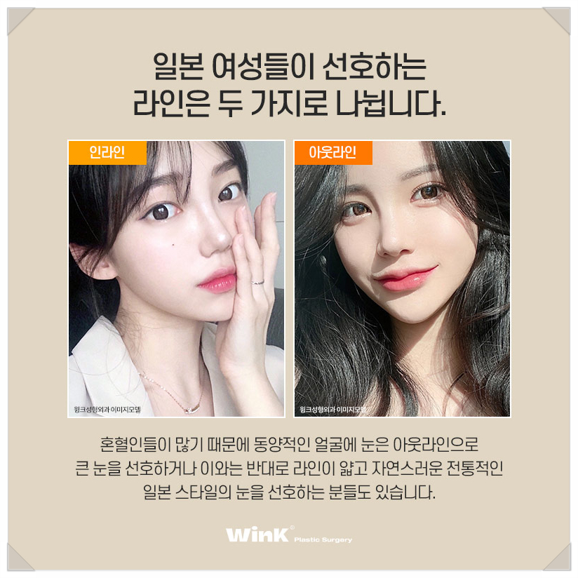 Japanese Double Eyelid Line? In-line Celebrity, Out-line Celebrity, and Wink Sinsa Natural Adhesion Double Eyelid Surgery image 3