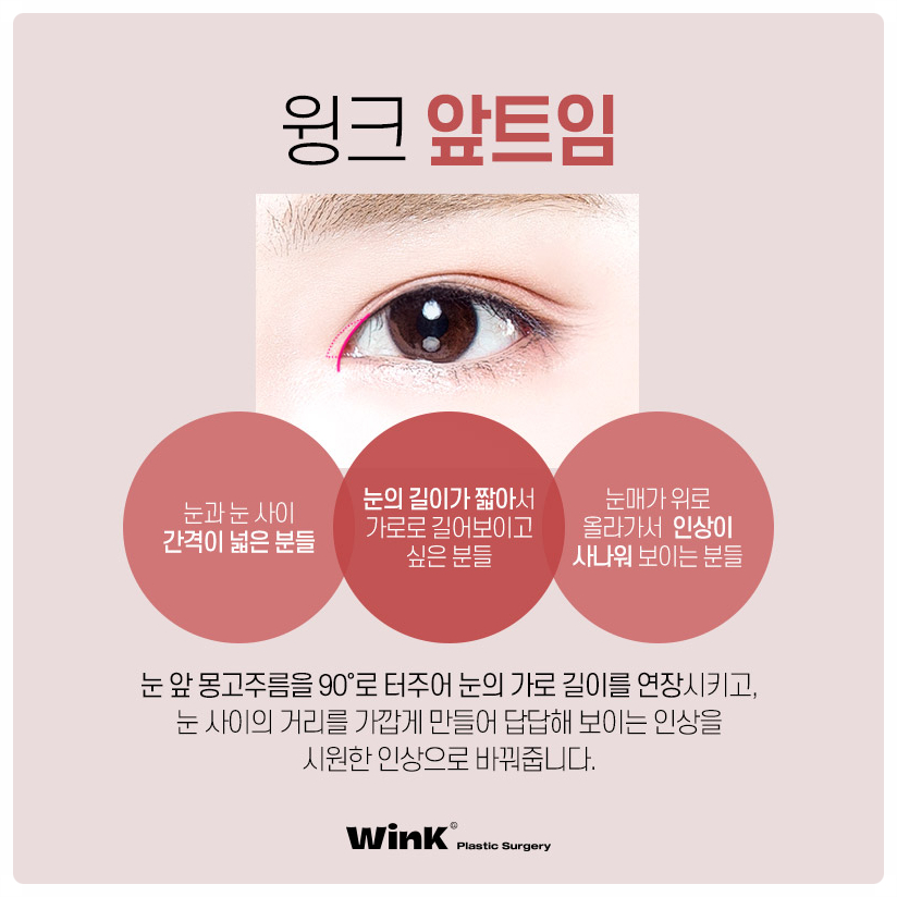Types of Eye Corner Surgery: Reviews of Epicanthoplasty, Upper Canthoplasty, Canthoplasty Before and After, Lower Canthoplasty Price, and Wink Plastic Surgery image 2