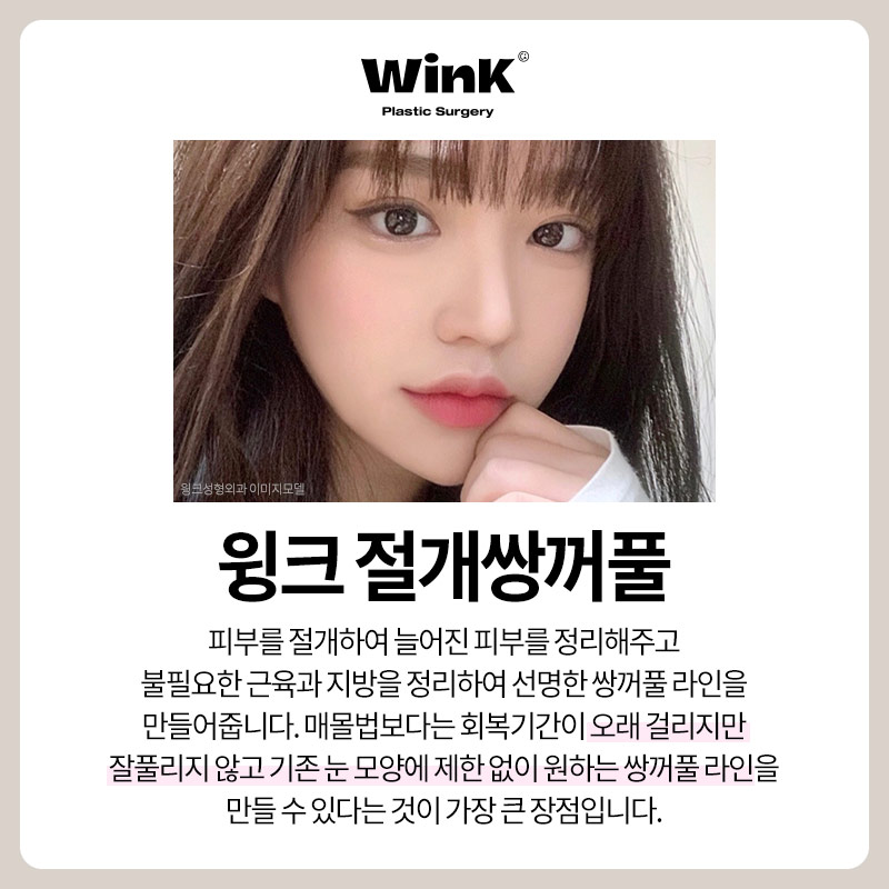 윙크성형외과 절개쌍꺼풀 풀리지 않고 또렷하게 관련 이미지 2