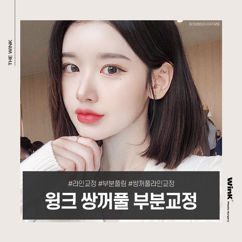 쌍꺼풀이 앞라인만 마음에 들지 않다면 윙크성형외과 쌍꺼풀 부분교정! 관련 이미지 4