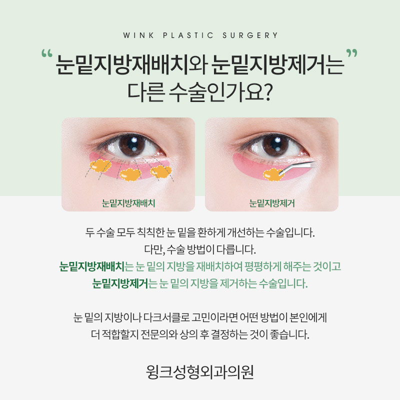 다크서클이 고민이라면, 윙크성형외과 눈밑지방재배치로 깔끔하게! 관련 이미지 6