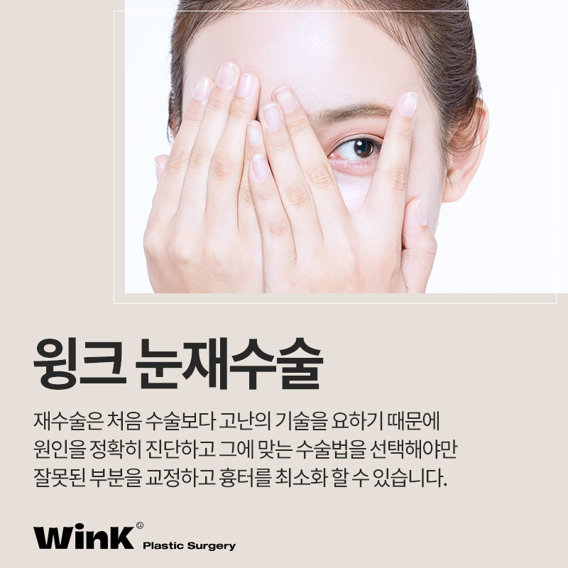 눈재수술 잘하는병원 마지막 눈재수술 관련 이미지 2