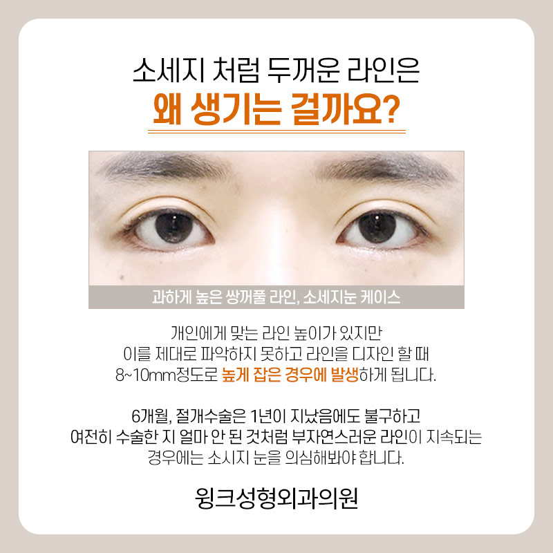 Let’s take a look at the differences before and after line lowering. image 2