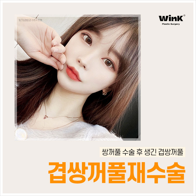 Multiple Eyelids, Double Eyelid Creases, Double Folded Eyelids, Eyelid Creases, Wink Plastic Surgery, Double Eyelids, Double Eyelid Revision Cost image 1