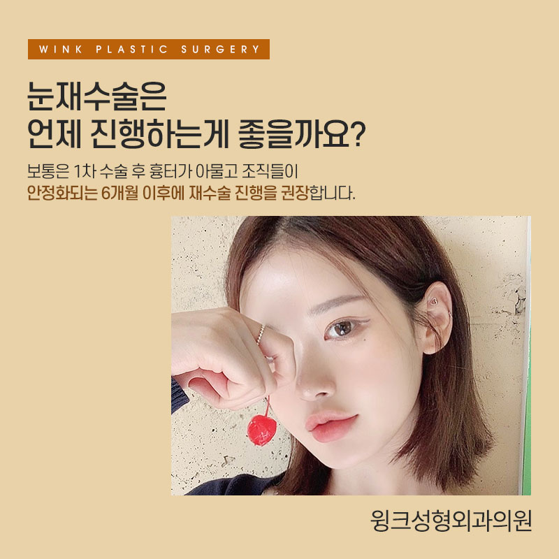 절개쌍꺼풀 재수술 시 알아야 둬야 할 것은 무엇일까요? 관련 이미지 5
