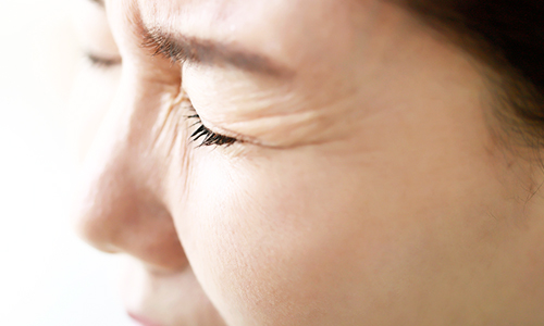 Double Eyelid Loosening: What Are the Causes and Solutions? image 4
