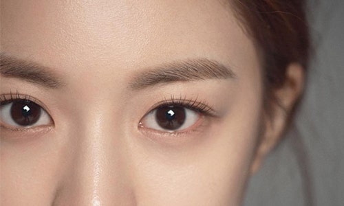 Let’s Take a Look at the Types of Double Eyelids. image 5