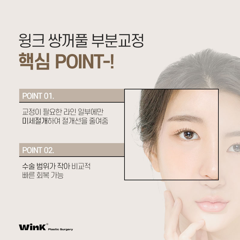 쌍꺼풀이 앞라인만 마음에 들지 않다면 윙크성형외과 쌍꺼풀 부분교정! 관련 이미지 6