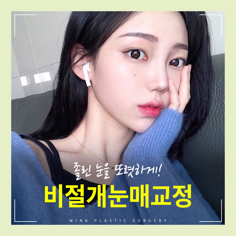 Improvement for Sleepy Eyes? Get Clear, Refreshing Eyes with Non-Incisional Eye Correction at Wink Plastic Surgery! image 5