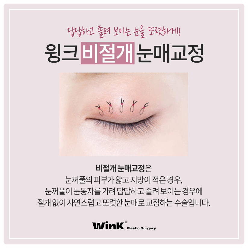 If you are looking into ptosis correction and double eyelid surgery before and after ptosis correction surgery at Sinsa Station, Wink Plastic Surgery image 4