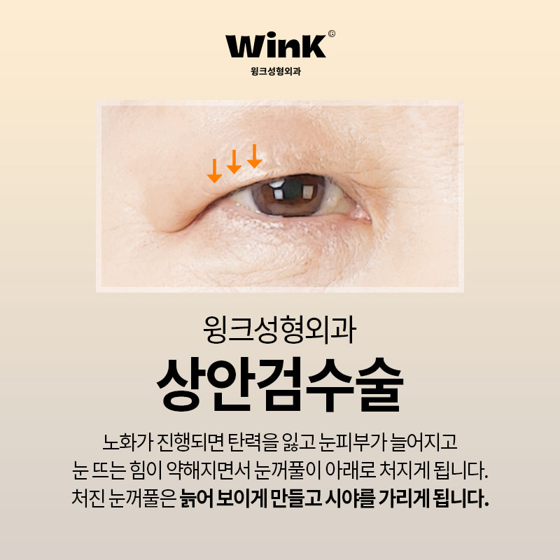 If you are looking into upper blepharoplasty for drooping eyelids near Sinsa Station? WINK Plastic Surgery Upper Blepharoplasty image 2