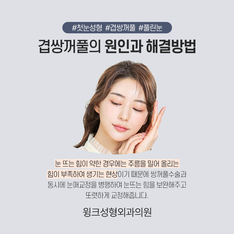 자연유착 쌍꺼풀수술로 겹주름을 해결하려면? 관련 이미지 5