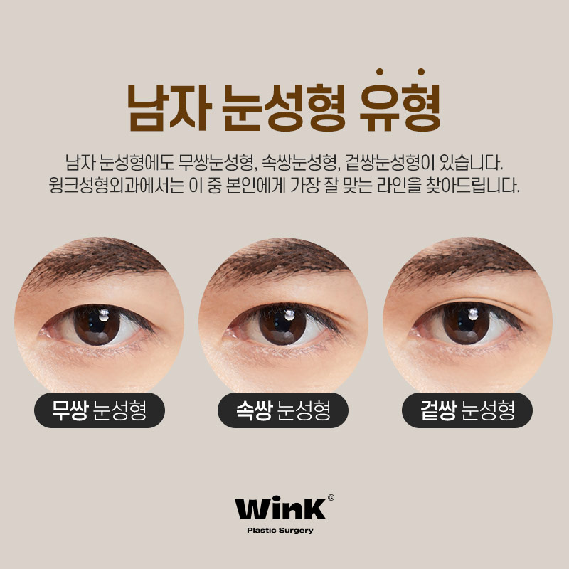 신사역 윙크성형외과 신사남자눈성형 남자쌍수후기 관련 이미지 3