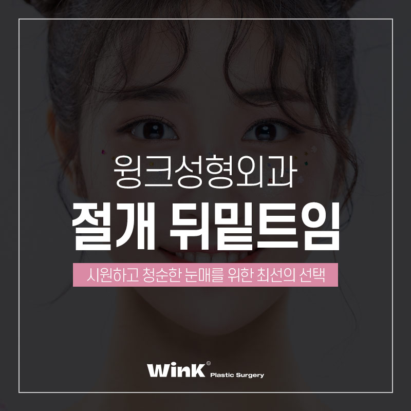 Elegant and Bright Eyes with Incisional Outer and Lower Canthoplasty at Wink Plastic Surgery! image 1