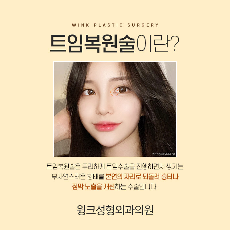 앞트임 복원 한달차 후기 관련 이미지 3