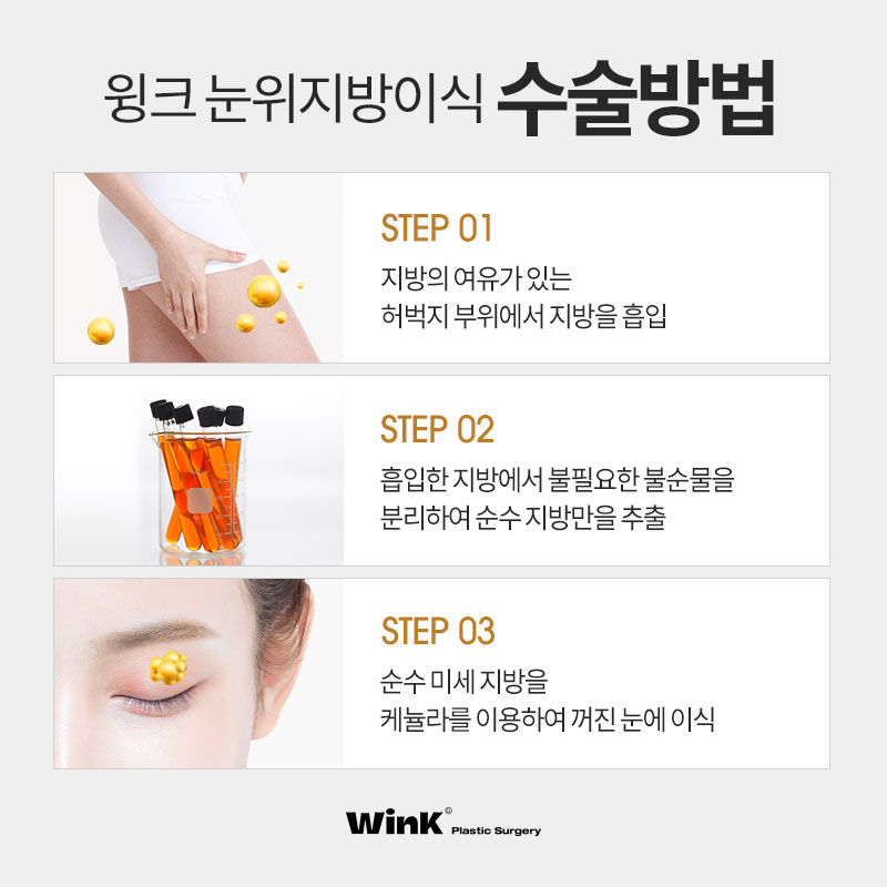 피곤해 보이는 눈은 이제 그만! 윙크 눈위지방이식으로 생기 있게! 관련 이미지 5