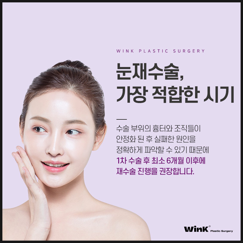 자연유착재수술 쌍수재수술 윙크성형외과 쌍꺼풀재수술 쌍꺼풀재수술후기 관련 이미지 6