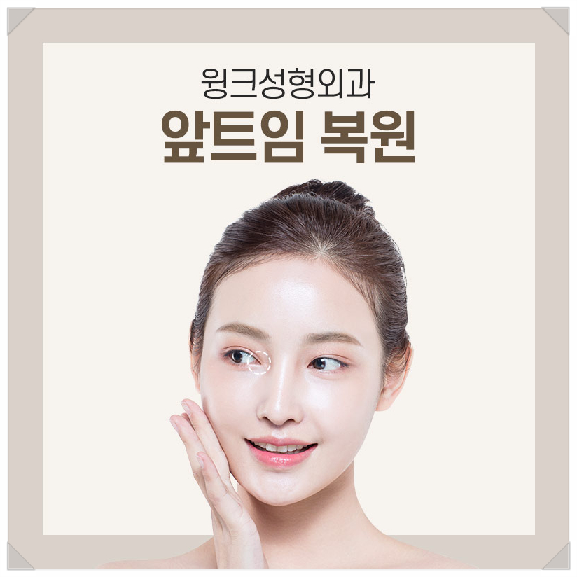 Recovery Period After Epicanthoplasty Restoration, Epicanthoplasty Scar, If You’re Only Looking Into Epicanthoplasty, Wink Plastic Surgery image 1