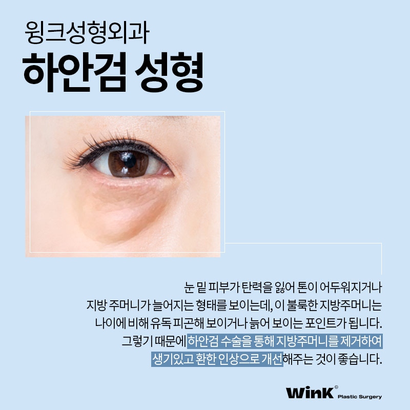 눈밑주름제거수술 눈밑주름에는  윙크성형외과 하안검수술후기 관련 이미지 2