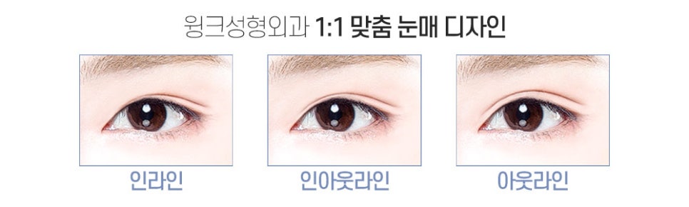 자연스럽고 잘 풀리지 않는 윙크 심플커브 자연유착 관련 이미지 8