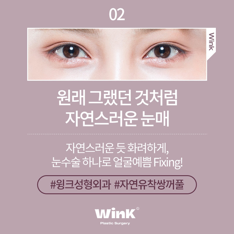 자연유착 쌍꺼풀 내것 같은 자연스러움 관련 이미지 3