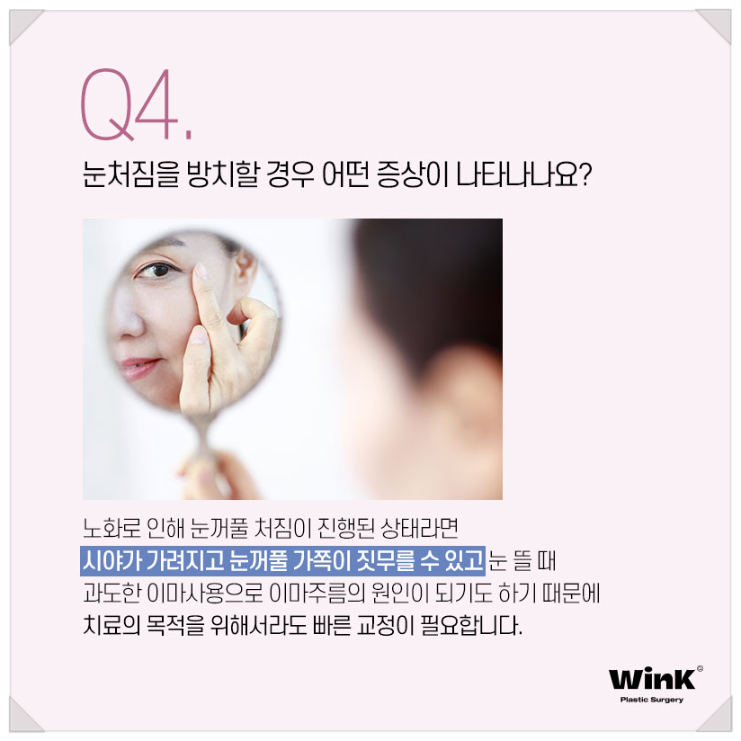 처진눈꺼풀수술 눈처짐수술 알아본다면 윙크성형외과 상안검수술 상안검수술회복기간 관련 이미지 8