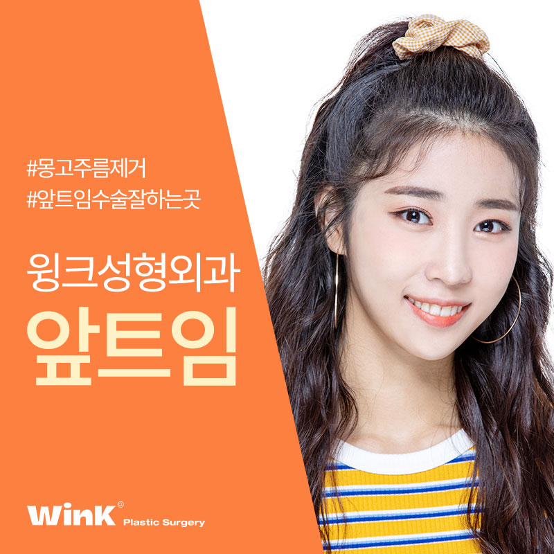 트임맛집 알아보고 있다면 윙크성형외과 신사앞트임비용 관련 이미지 1