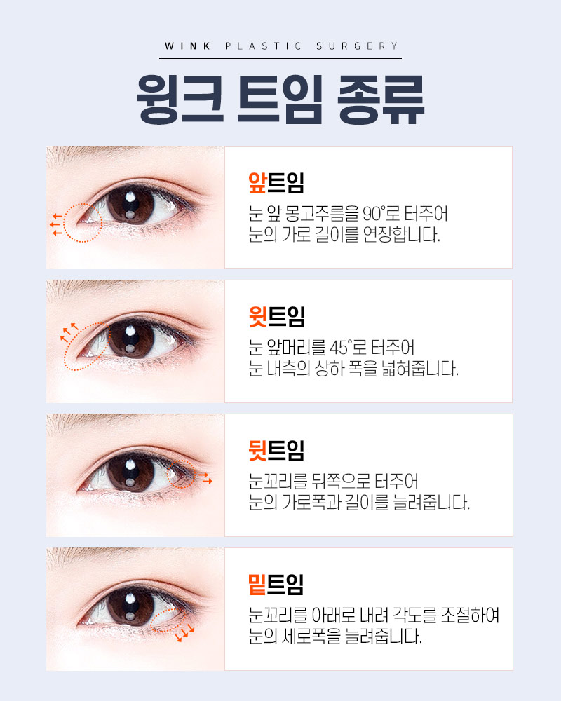 윙크성형외과에서 추천하는 눈 유형별 트임 성형? 관련 이미지 2