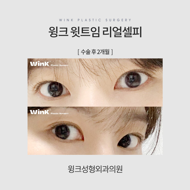 윗트임에 대해 알아보겠습니다. 관련 이미지 8