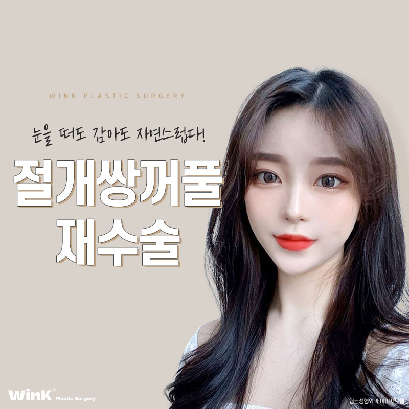 눈을 떠도, 눈을 감아도 자연스러운 윙크성형외과 절개쌍꺼풀 재수술 관련 이미지 1
