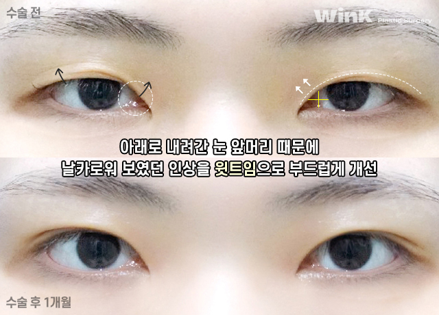 윙크 윗트임으로 날카로운 눈매를 부드럽게! 관련 이미지 8