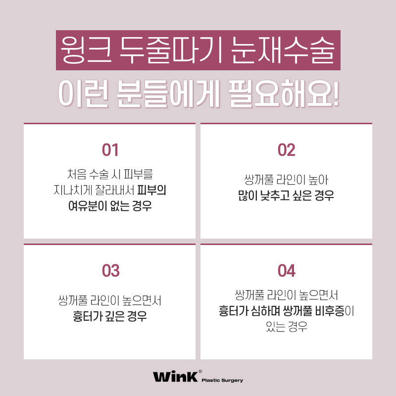 두껍고 높은 소세지눈? 윙크성형외과 두줄따기 눈재수술로 개선 관련 이미지 5