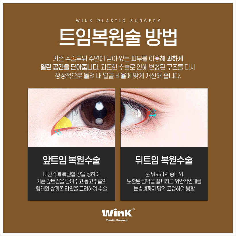 If You’re Looking Into Canthoplasty Revision, WINK Plastic Surgery Medial Canthoplasty Revision Medial Canthoplasty Revision Price Lateral Canthoplasty Reconstruction image 5