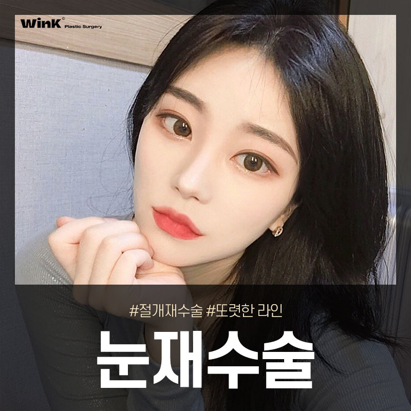 절개쌍꺼풀 재수술 시 알아야 둬야 할 것은 무엇일까요? 관련 이미지 1