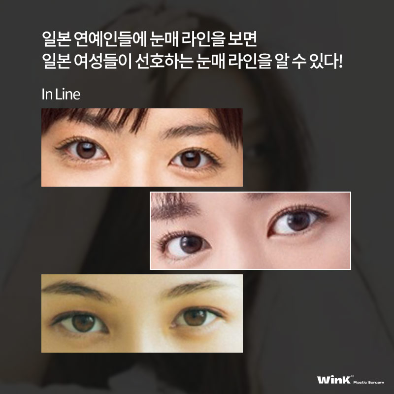 Coming to Korea from Japan for Plastic Surgery? WinK Plastic Surgery Explains the Japanese Double-Eyelid Line Preferred by Japanese Women! image 5