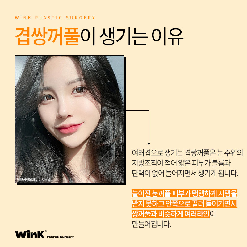 Can Double-Eyelid Surgery Be Done for Double-Fold Eyelids? Wink Plastic Surgery Explains! image 3