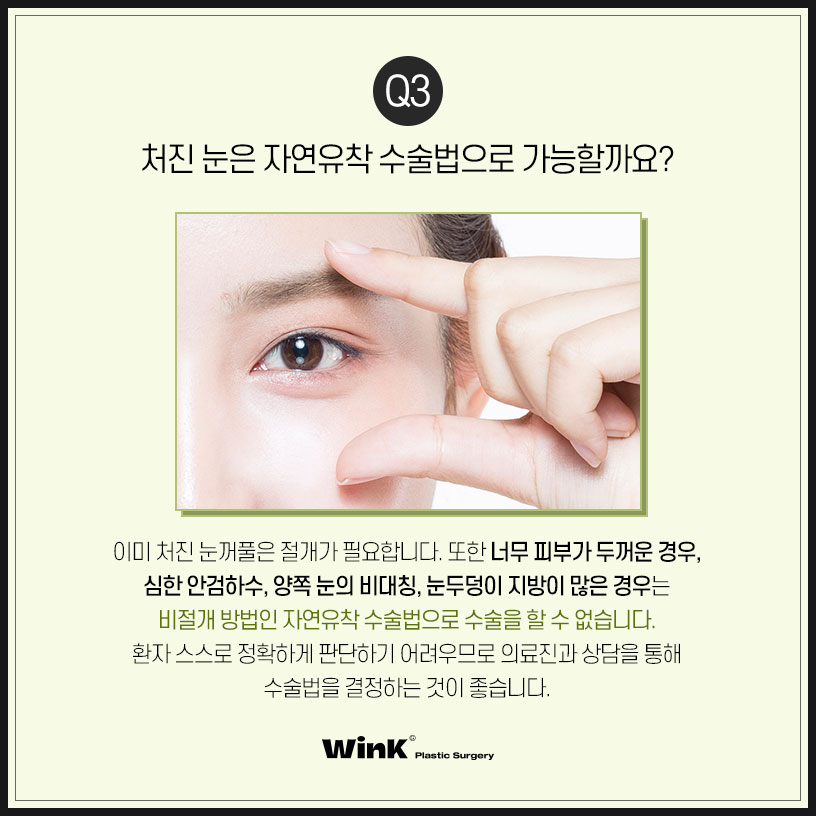 쌍수자연유착의 모든것 윙크에서 알려드려요 자연유착쌍꺼풀후기 쌍꺼풀수술잘하는곳 관련 이미지 4